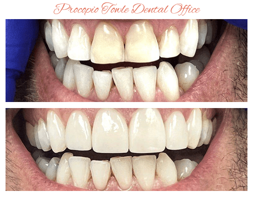 Walnut Creek Dentist