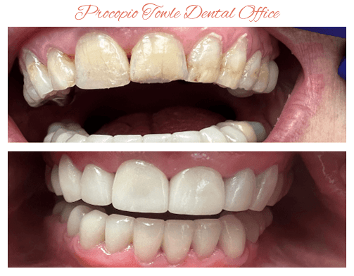 Walnut Creek Dentist