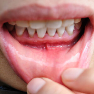 Walnut Creek Dentist